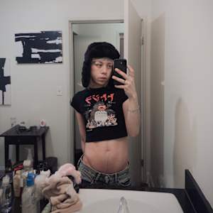 Anthony