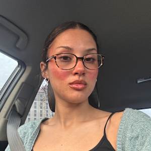 alana