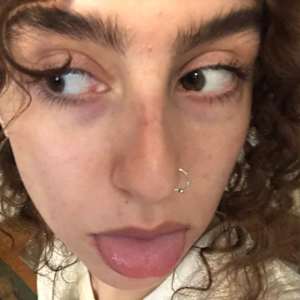 Zoe