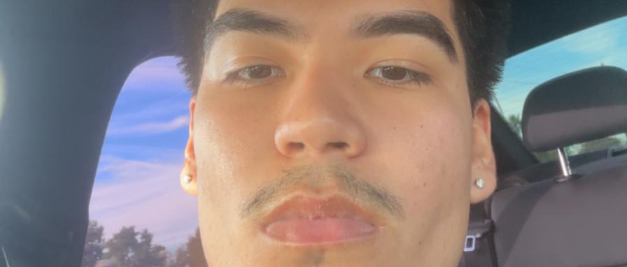 alberto