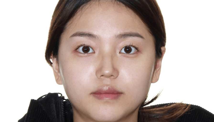 Sera LIn