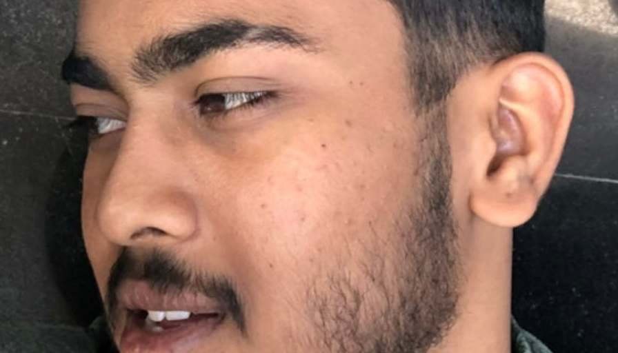 Nishchal