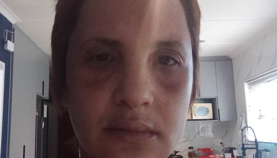 Roxy Kote
