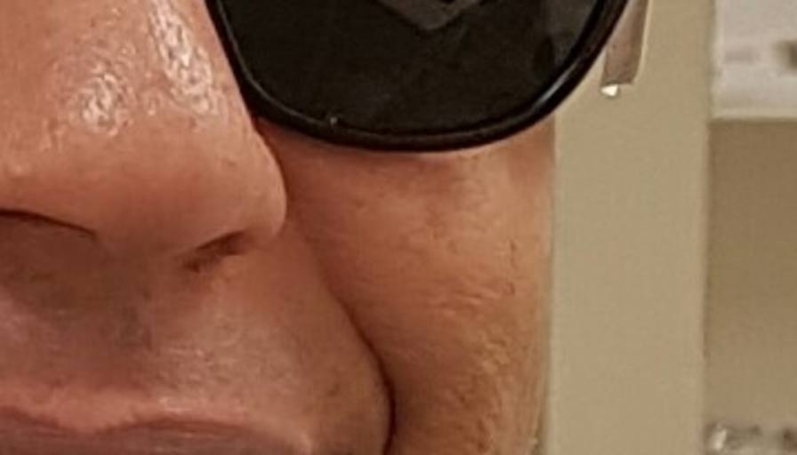 Ham