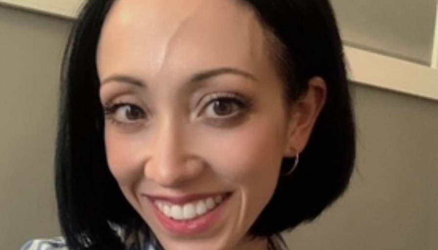 Alana
