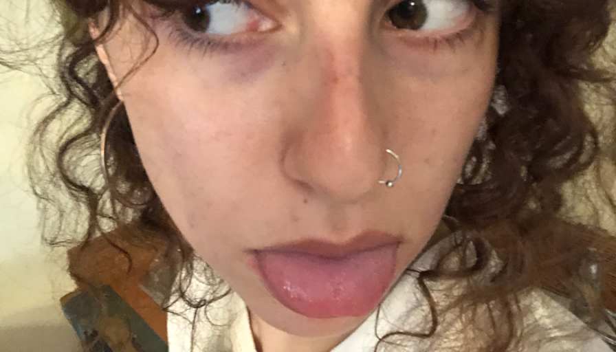 Zoe