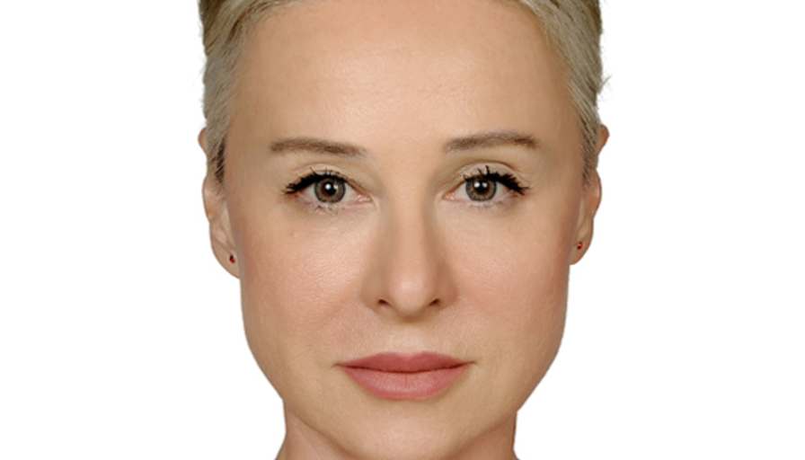 Berna