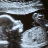 Baby  Number Three