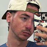 James