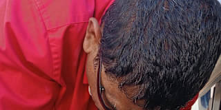Alberto mejora