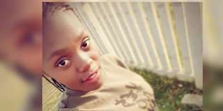 Melanin