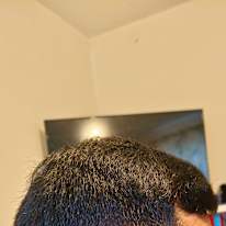 suresh reddy