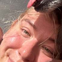 Rachel Driedger