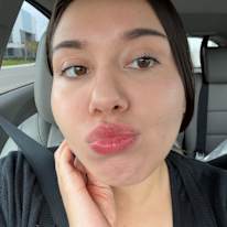 Alexis