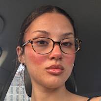 alana