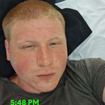 Anthony